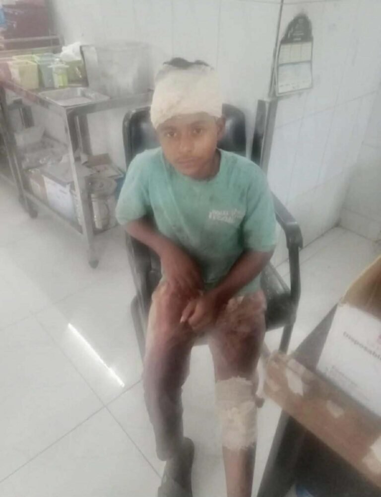 সোনারগাঁয়ে ব্যবসায়ীর ১০ লাখ টাকা ছিনতাই, ৩ জনকে কুপিয়ে ও পিটিয়ে জখম