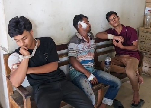 রূপগঞ্জে তুচ্ছ ঘটনাকে কেন্দ্র করে ২ শিক্ষার্থীসহ ৩ জনকে কুপিয়ে জখম